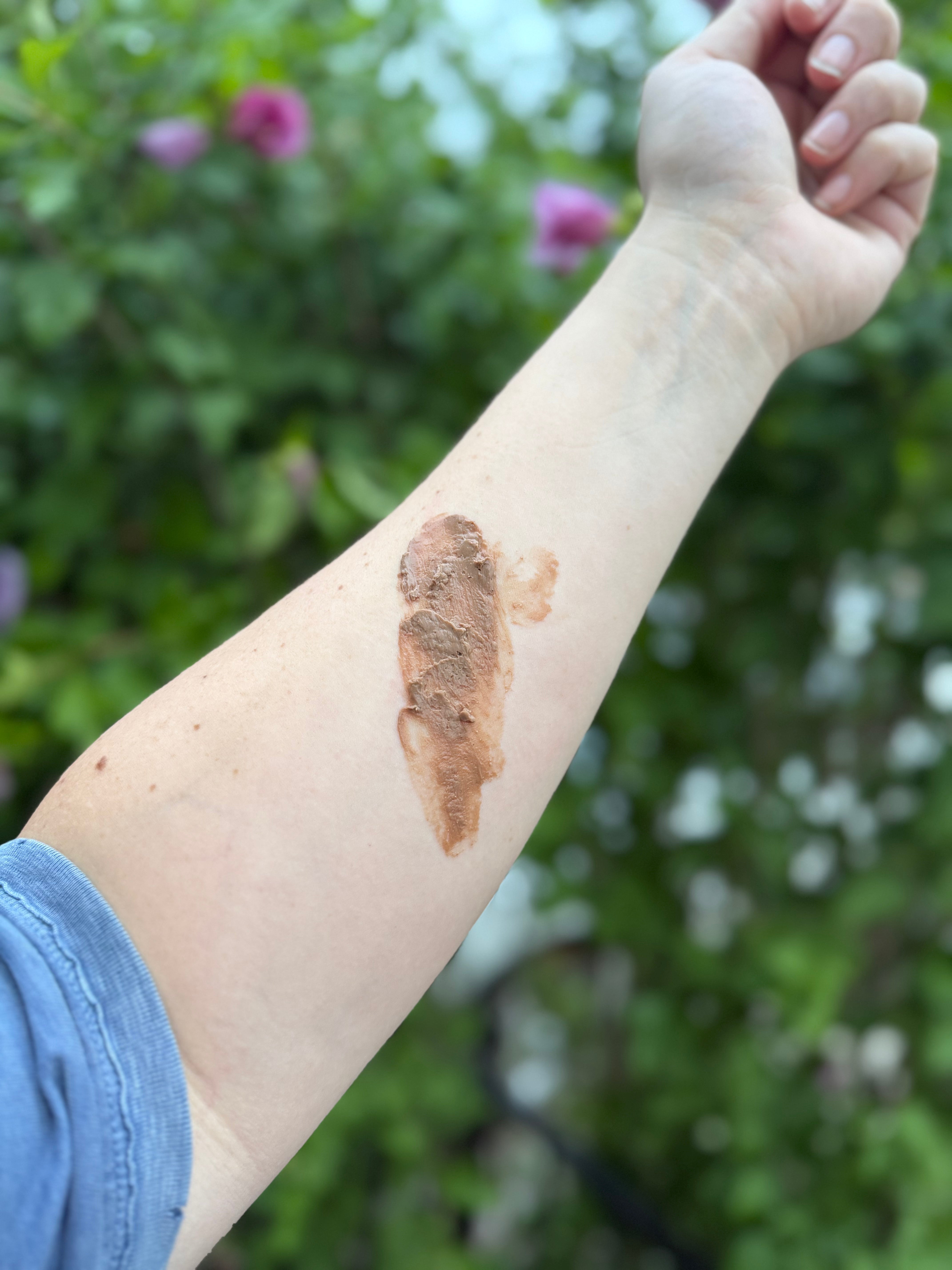 Brown stain on a person's arm with a blurred green outdoor background