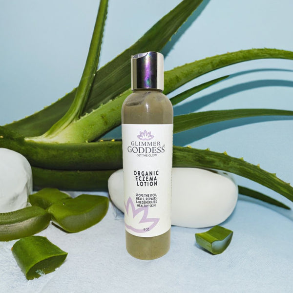 Organic eczema relief lotion in white bottle by Glimmer Goddess natural skincare